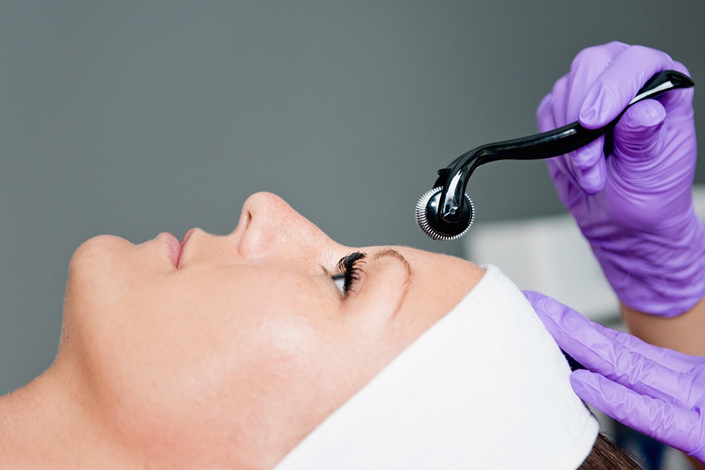 an image of a woman getting collagen induction therapy
